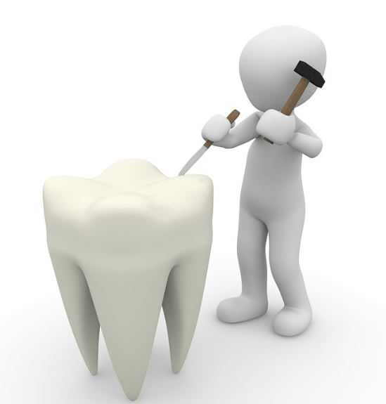 Skygate Dental Emergency Cavity